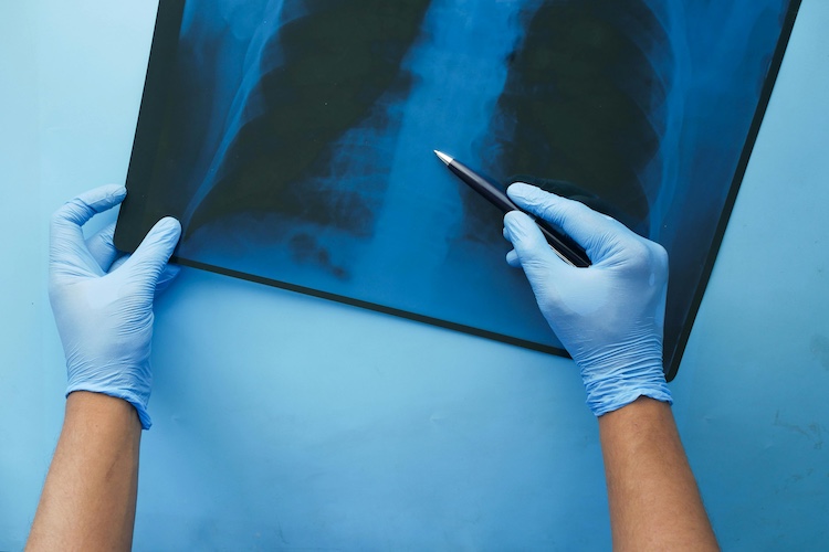 Personal Injury Medical Experts