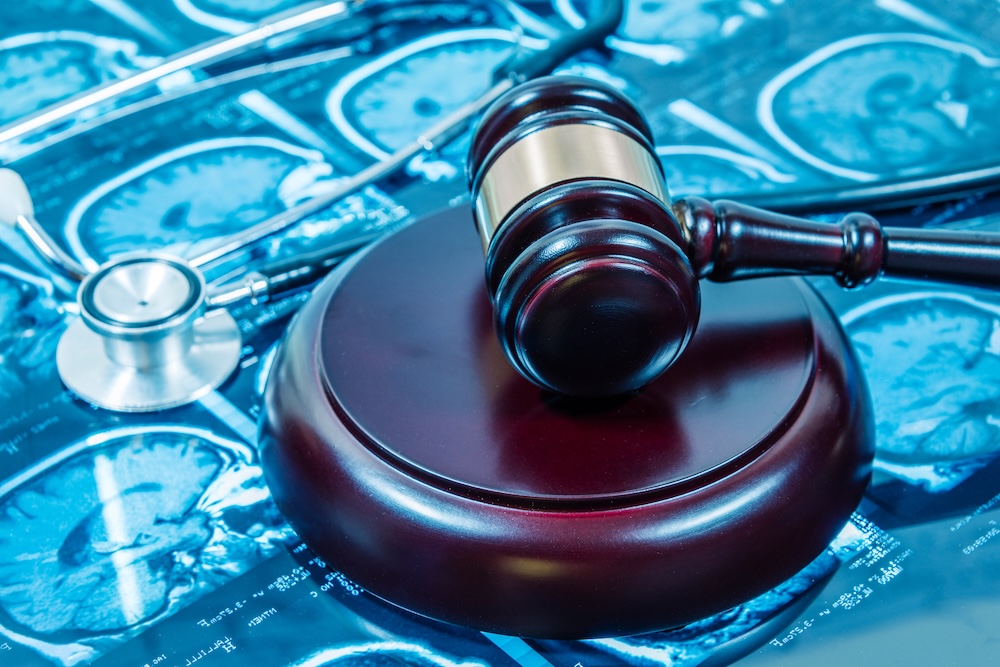 Jassim Law | Best Personal Injury Lawyer in San Diego